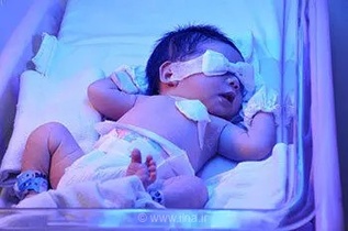 زردی نوزادان: چه زمانی باید به پزشک مراجعه کرد؟