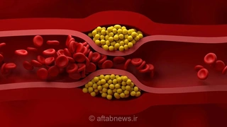 سن ابتلا به سکته قلبی در ایران کاهش یافت/ افزایش خطر در مردان بالای ۳۰ سال