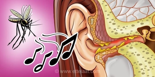 چرا پشه‌ها به سمت گوش انسان جذب می‌شوند؟
