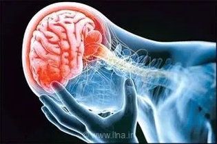 سکته مغزی در ایران ۱۰ سال زودتر؛ ضرورت پیشگیری و دسترسی به درمان