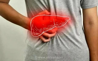 کبد چرب؛ شایع‌ترین بیماری کبدی در جهان که حدود ۴۰ درصد از مردم ایران را درگیر کرده است
