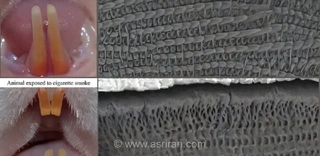 هشدار به والدین: دود دست‌دوم سیگار چگونه سلامت مینای دندان نوزادان را در سکوت تخریب می‌کند؟