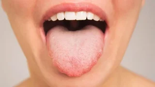 ارتباط احتمالی باکتری‌های دهان با سرعت تفکر و عملکرد شناختی