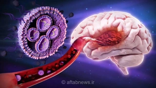 روشی نوآورانه برای مقابله با مرگبارترین سرطان مغز