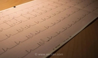 سندرم مرگ ناگهانی بزرگسالان (SADS): علت مرگ بازیکن ولزی چه بود؟