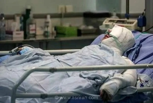 آمار هشداردهنده سوختگی در ایران؛ کمبود تخت‌های بیمارستانی و هزینه‌های سنگین درمان