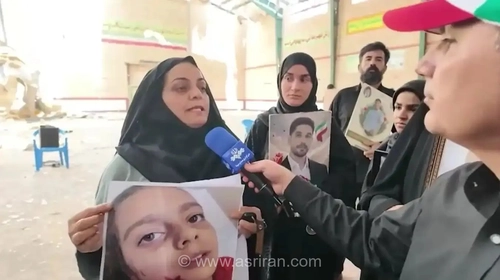 عکس تکان دهنده از یک کودک خردسال بعد از اصابت ساچمه به صورتش