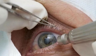فریاد استمداد پدری رنج‌دیده در بجستان: از عمل قلب باز و نابینایی تا قطع یارانه و معیشت دشوار خانواده