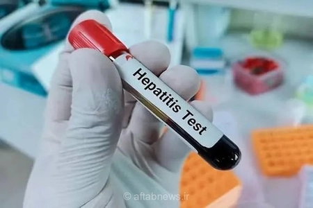 هپاتیت فقط یک بیماری ویروسی نیست؛ هشدارهای مهم متخصص گوارش درباره علل پنهان التهاب کبد