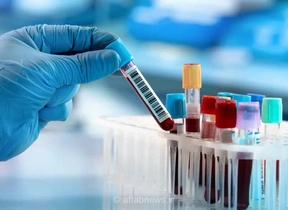 کاهش خطای آزمایشگاهی در ایران به زیر یک درصد؛ نیاز به حمایت بیشتر
