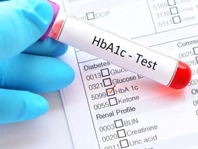آزمایش HbA1c چیست و چگونه میانگین قند خون سه ماه گذشته را نشان می‌دهد؟