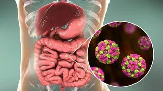 تفاوت مسمومیت غذایی و ویروس معده: علائم و راه‌های پیشگیری