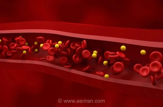 9 تغییر ساده برای بهبود سطح چربی خون و کاهش خطر بیماری‌های قلبی