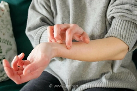 راز خارش بدن فاش شد؛ موهای کرکی چگونه به عنوان سیستم هشداردهنده در بدن عمل می‌کنند؟