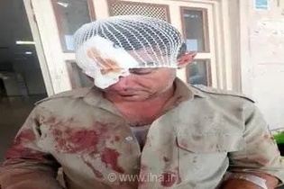 دو محیط‌بان پارک ملی کرخه در درگیری با متخلفان شکار غیرمجاز مصدوم شدند