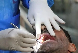 بحران در دندانپزشکی ایران؛ رئیس جامعه دندانپزشکی از تاثیر مستقیم نوسانات نرخ دلار بر قیمت مواد مصرفی خبر داد