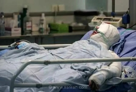 آمار هشداردهنده سوختگی در ایران؛ کمبود تخت‌های بیمارستانی و هزینه‌های سنگین درمان