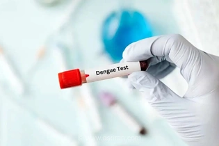 شناسایی بیش از هزار مورد ابتلا به تب دنگی در کشور؛ هشدار وزارت بهداشت درباره پیشگیری و درمان