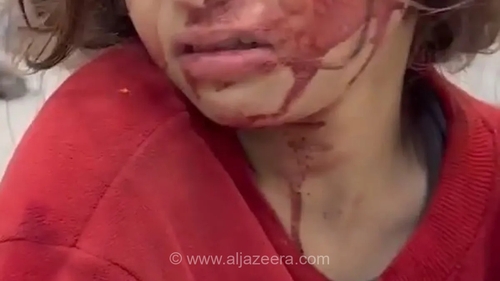 وکیل: هدف قرار دادن زنان فلسطینی توسط اسرائیل مصداق نسل‌کشی است