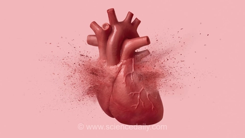 سندرم قلب شکسته چگونه از حمله قلبی تشخیص داده می‌شود؟ تست جدیدی برای تمایز
