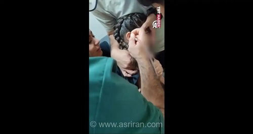 کودک ۵ ساله ترکیه‌ای پس از یک ماه درد گوش، با کنه در گوشش به بیمارستان رفت