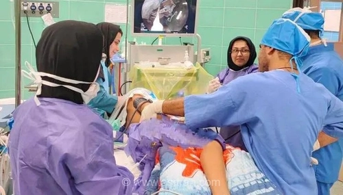 خروج موفقیت‌آمیز سوزن بلعیده شده از روده کودک ۱۰ ساله در رشت توسط تیم پزشکی