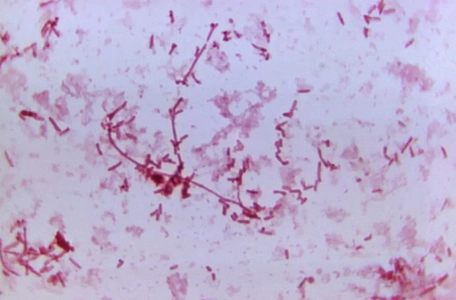 عامل بیماری طاعون: باکتری Yersinia pestis در تصویر میکروسکوپی