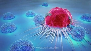 6 راهکار کلیدی برای کاهش خطر ابتلا به سرطان ریه