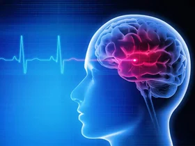 تشخیص سریع علائم سکته مغزی، نجات‌بخش است