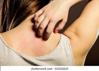 خارش پوست: هشداری برای تشخیص زودهنگام سرطان؟