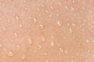 عرق چه تاثیری بر سلامت پوست دارد؟