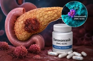 تأییدیه FDA برای داروی جدید درمان سرطان لوزالمعده؛ امید تازه‌ای برای بیماران