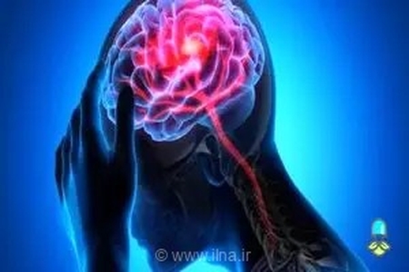 آیا سرگیجه نشانه سکته مغزی است؟ هشدارهای پزشکی که نباید نادیده بگیرید