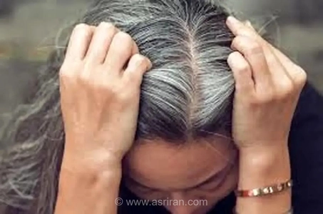 کدام ویتامین‌ها برای سلامت مو ضروری هستند و نشانه‌های کمبود آن‌ها چیست؟