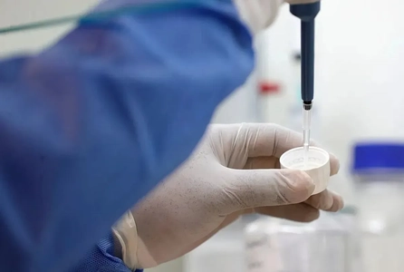 هشدار اپیدمیولوژیست درباره طاعون: غربالگری مسافران ورودی از روسیه ضروری است
