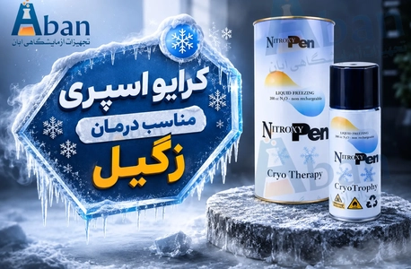 کرایو اسپری برای درمان زگیل؛ روشی موضعی و سریع