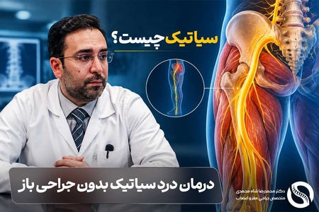 سیاتیک چیست؟ علائم و روش‌های درمان غیرجراحی با توضیحات دکتر شاه محمدی