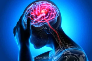 سکته مغزی: علائم هشداردهنده و تفاوت سکته ایسکمیک با خونریزی