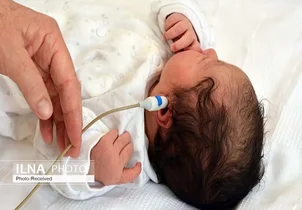 غربالگری شنوایی ۹۹ درصد نوزادان فارس؛ شناسایی ۱۶۸ کودک کم‌شنوا