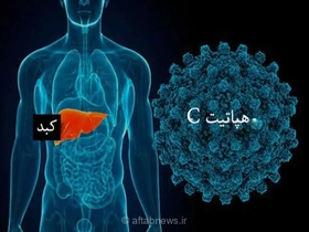 هپاتیت C بیماری خاموش؛ امکان درمان با داروهای خوراکی علی‌رغم نبود واکسن پیشگیرانه
