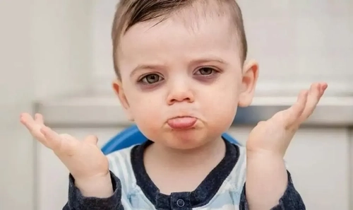 علت‌های تیرگی زیر چشم کودکان