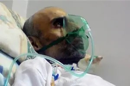 حدود ۶۷ هزار جانباز شیمیایی در کشور زندگی می‌کنند