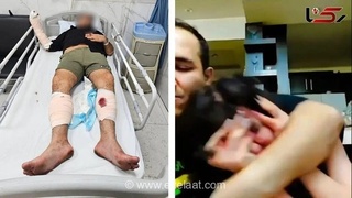 پایان قدرت‌نمایی بلاگر هتاک در اینستاگرام؛ شکنجه‌گر زنان با شلیک پلیس زمین‌گیر و راهی بیمارستان شد