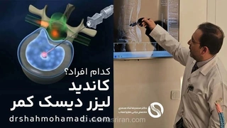 چه کسانی کاندیدای مناسب درمان لیزری دیسک کمر هستند؟