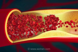 نشانه های آسیب عروقی در جوانان؛ خطری که زودتر از انتظار خود را نشان می‌دهد