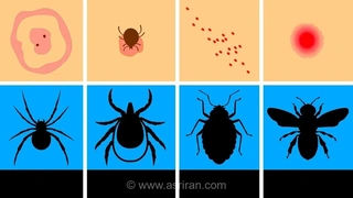 راهنمای کامل تشخیص انواع گزش حشرات از روی شکل ظاهری پوست (+اینفوگرافیک)