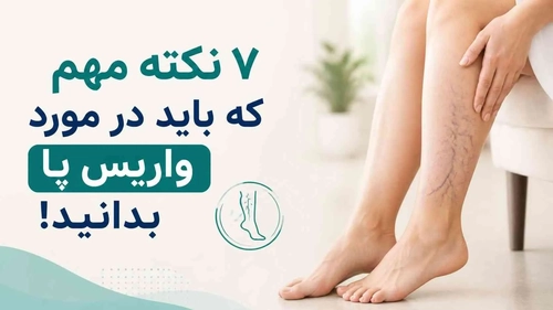 ۷ نکته مهم که باید در مورد واریس پا بدانید!