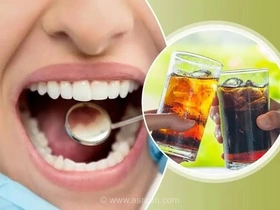 نوشابه های بدون قند هم می توانند به دندان آسیب بزنند