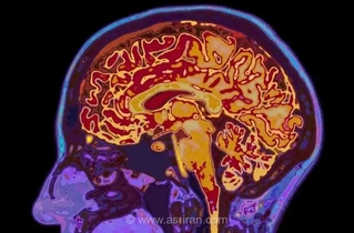 فلسفه ذهن: بررسی ماهیت آگاهی و ارتباط آن با مغز
