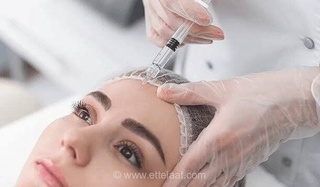 کاربردهای متنوع بوتاکس فراتر از زیبایی؛ از میگرن تا کنترل مثانه